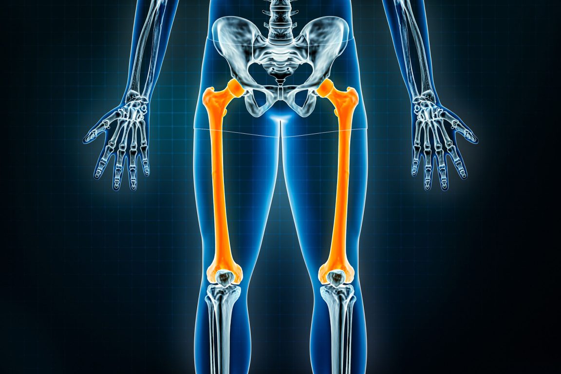 X-Ray of lower extremities